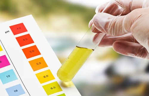 What Does A Urine Test Show