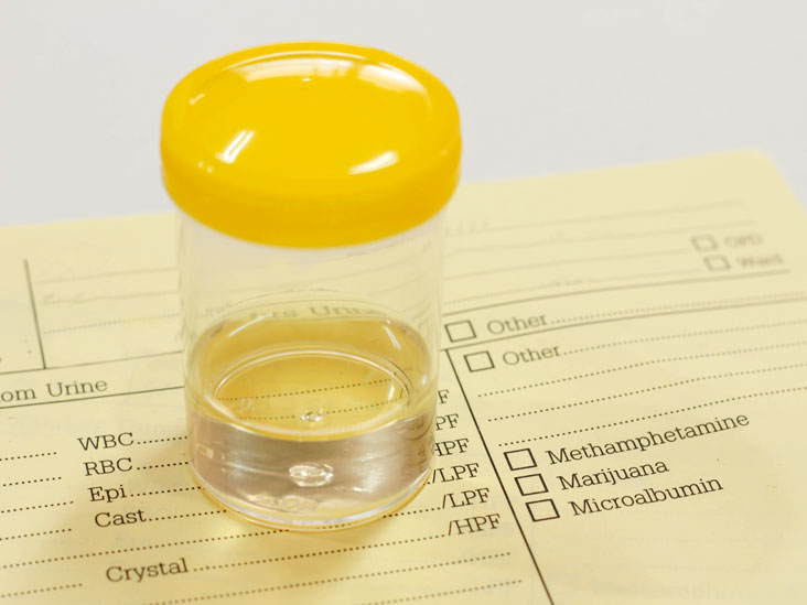 urine collecton for test